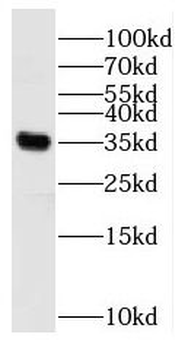 RBM11 Antibody