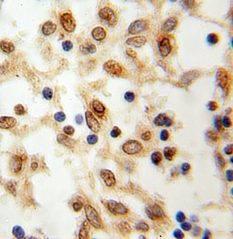 RBM15 Antibody