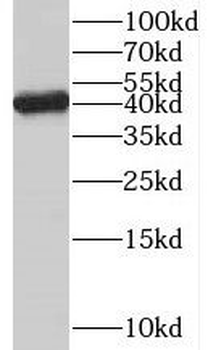 RBM17 Rabbit Polyclonal Antibody