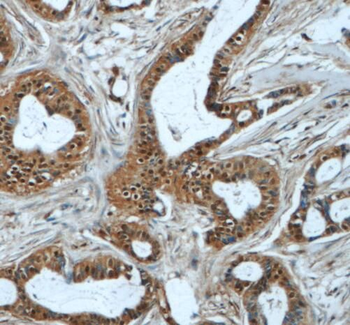 RBM25 Antibody