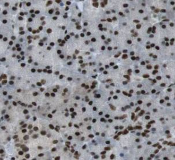 RBM39 Antibody