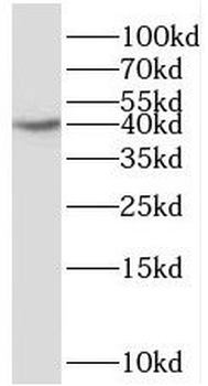 RBM4 Antibody