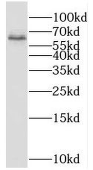 RBM46 Rabbit Polyclonal Antibody