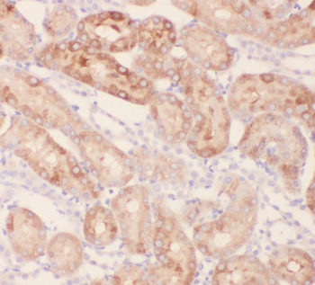 RBM46 Antibody