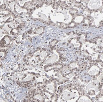 RBM6 Antibody