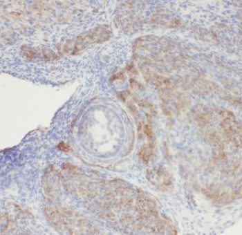RBM8A Antibody