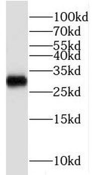 RBMX2 Antibody