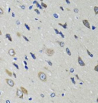 RBP4 Antibody