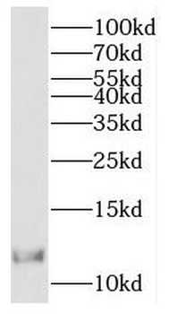 RBX1 Antibody