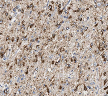 RCAN2 Antibody