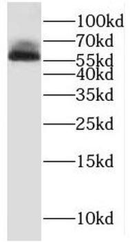 RCBTB2 Antibody