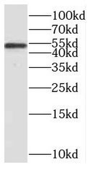 RCC1 Rabbit Polyclonal Antibody