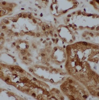 RCC1 Rabbit Polyclonal Antibody
