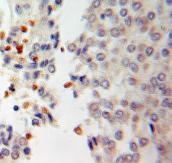 RCC1 Antibody
