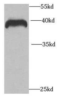 RCN2 Antibody