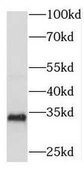 RDM1 Antibody