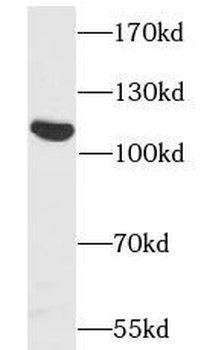 RECK Rabbit Polyclonal Antibody