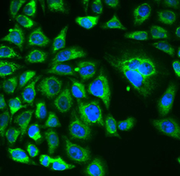 RCVRN Antibody