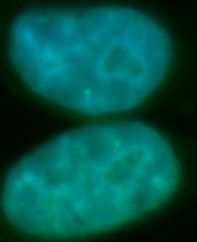 RECQL5 Antibody
