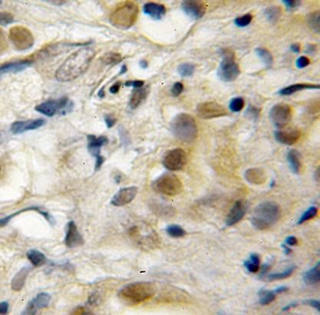 RECQL5 Antibody