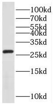 REEP2 Rabbit Polyclonal Antibody