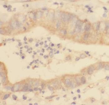 REEP5 Antibody