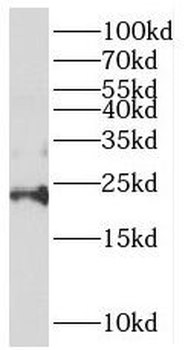 REEP6 Antibody