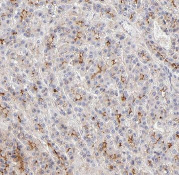 RELN Rabbit Polyclonal Antibody