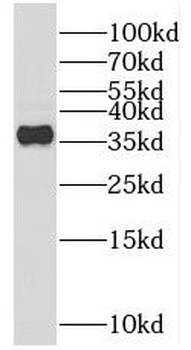 REM2 Rabbit Polyclonal Antibody
