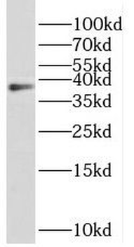 REN Rabbit Polyclonal Antibody