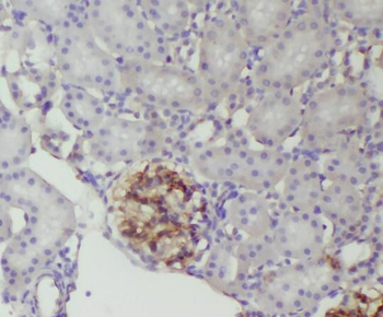 REN Rabbit Polyclonal Antibody