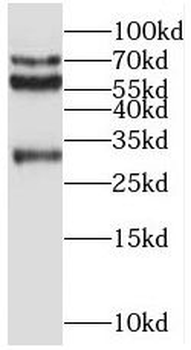 REPS2 Antibody