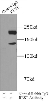 REST Antibody