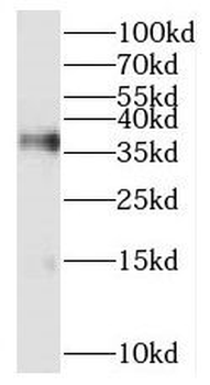 RFC2 Antibody