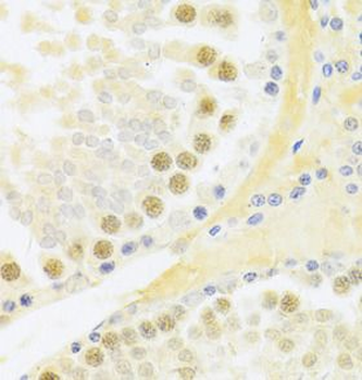 RFC4 Antibody