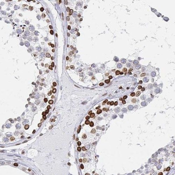 RFWD3 Antibody