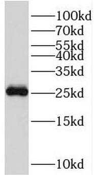 RGR Rabbit Polyclonal Antibody