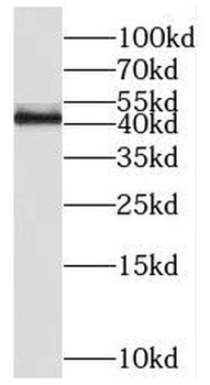 RGS5 Antibody