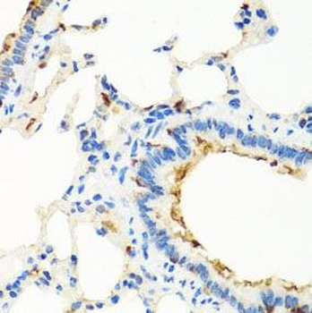 RGS5 Antibody
