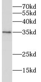 RHBDL2 Antibody
