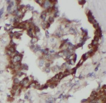 RHCG Antibody