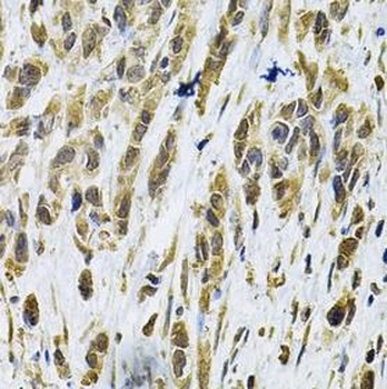 RHOA Rabbit Polyclonal Antibody
