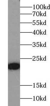 RHOB Antibody