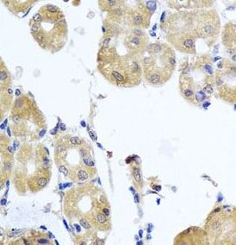 RHOB Antibody