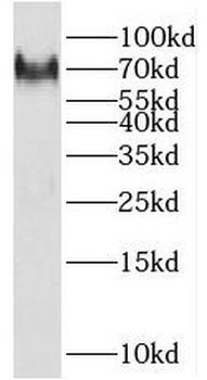 RHOBTB3 Antibody