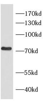 RHOT2 Antibody