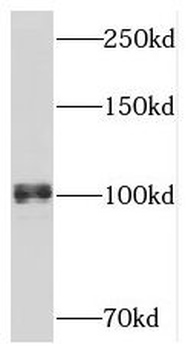 APBB1IP Antibody