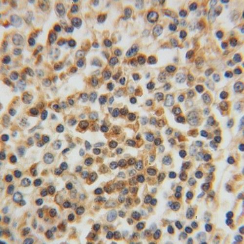 APBB1IP Antibody
