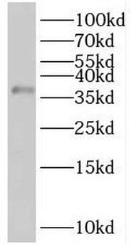 RIBC2 Rabbit Polyclonal Antibody