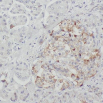 RIC8A Antibody